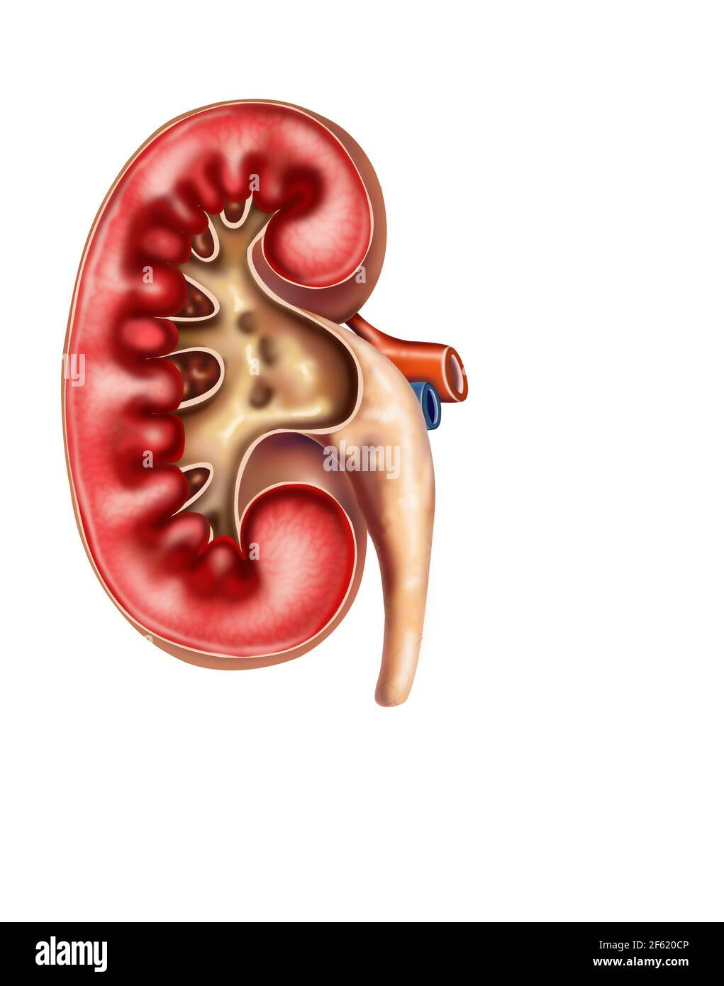 Glomerulonefritis Kronis